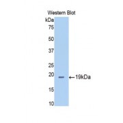 Western blot analysis of the recombinant protein.