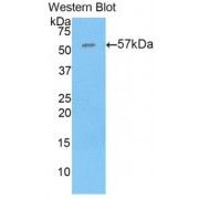 Western blot analysis of the recombinant Mouse THBS4 protein.