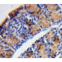 Tryptase Delta 1 (TPSd1) Antibody