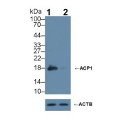 abx101693