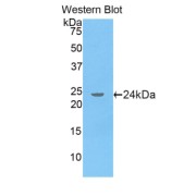 abx101710