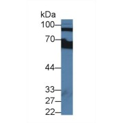 Western blot analysis of Human Serum, using Human CFB Antibody (2 µg/ml) and HRP-conjugated Goat Anti-Rabbit antibody (<a href="https://www.abbexa.com/index.php?route=product/search&amp;search=abx400043" target="_blank">abx400043</a>, 0.2 µg/ml).