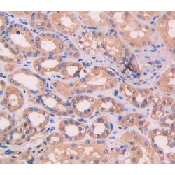 Complement Factor B (CFB) Antibody