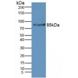 Complement Factor B (CFB) Antibody