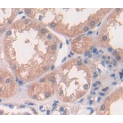 Complement Factor D (CFD) Antibody