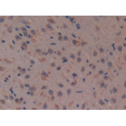 Complement Factor H (CFH) Antibody
