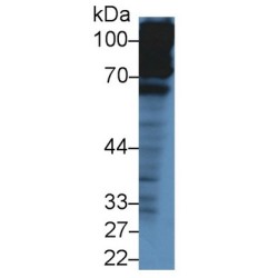 Complement Factor H (CFH) Antibody
