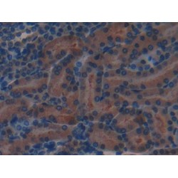 Complement Factor H (CFH) Antibody