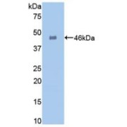 Western blot analysis of recombinant Human GLa.