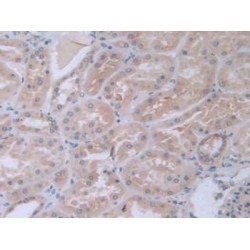 Galactosidase Alpha (GLa) Antibody