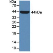 Western blot analysis of recombinant Human GLA.