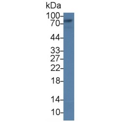 Glucuronidase Beta (GUSb) Antibody