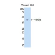 abx101763