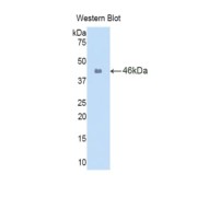 Western blot analysis of the recombinant protein.