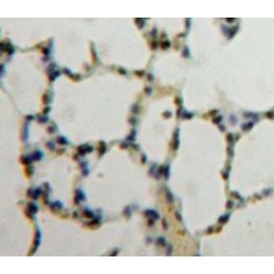 Nucleoporin 88 kDa (NUP88) Antibody