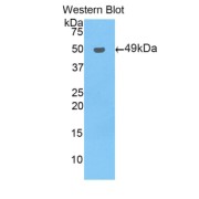 Western blot analysis of the recombinant protein.