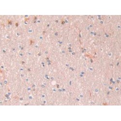 Alpha-1-Antitrypsin (SERPINA1) Antibody
