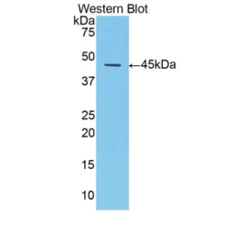 Alpha-1-Antitrypsin (SERPINA1) Antibody