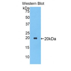 Alpha-1-Antiproteinase (SERPINA1) Antibody