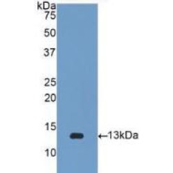 Beta-2-Microglobulin (B2M) Antibody