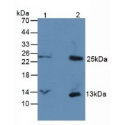 Western blot analysis of (1) Rat Serum Tissue, and (2) Rat Spleen Tissue, using Rabbit Anti-Human bTG Antibody (3 µg/ml) and HRP-conjugated Rabbit Anti-Mouse antibody (<a href="https://www.abbexa.com/index.php?route=product/search&amp;search=abx400002" target="_blank">abx400002</a>, 1:5000 dilution).