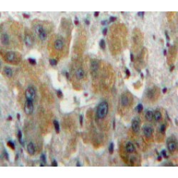 Carbonic Anhydrase I (CA1) Antibody
