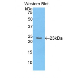 Chromobox Homolog 3 (CBX3) Antibody