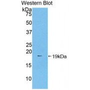 Western blot analysis of recombinant Mouse F2 Protein.
