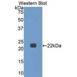 Collagen Type XVII Alpha 1 (COL17A1) Antibody