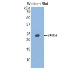 Interferon Alpha 5 (IFNa5) Antibody