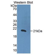 abx101887