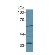 Western blot analysis of Mouse Liver lysate, using Mouse LIPG Antibody (1 µg/ml) and HRP-conjugated Goat Anti-Rabbit antibody (<a href="https://www.abbexa.com/index.php?route=product/search&amp;search=abx400043" target="_blank">abx400043</a>, 0.2 µg/ml).