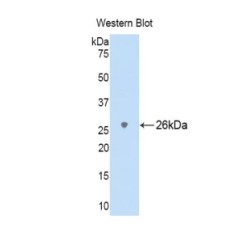 Lymphocyte Antigen 9 (LY9) Antibody