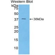 Western blot analysis of the recombinant protein.