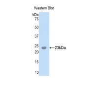 Western Blot analysis of recombinant Human PXDN protein.