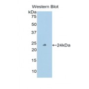 Western blot analysis of recombinant Human PXDN.