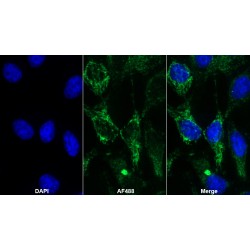 Peroxidasin Homolog (PXDN) Antibody