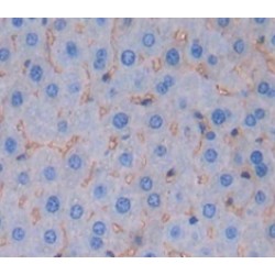 Protease, Serine 8 (PRSS8) Antibody