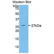 Western blot analysis of recombinant Human TFR.