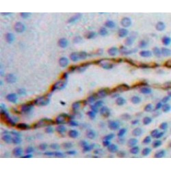 Transferrin Receptor Protein 1 / CD71 (TFRC) Antibody