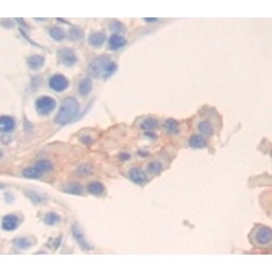 Transferrin Receptor Protein 1 / CD71 (TFRC) Antibody
