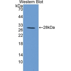 Transferrin Receptor Protein 1 / CD71 (TFRC) Antibody