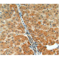 Acetylcholinesterase (AChE) Antibody