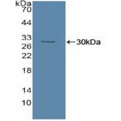 Acid Sphingomyelinase (ASM) Antibody