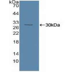 Sphingomyelin Phosphodiesterase (SMPD1) Antibody