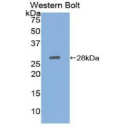 Western blot analysis of recombinant Human ADCY5 Protein.