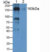Western blot analysis of (1) Human Lung Tissue and (2) Human hepG2 Cells.