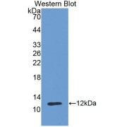 Western blot analysis of the recombinant protein.