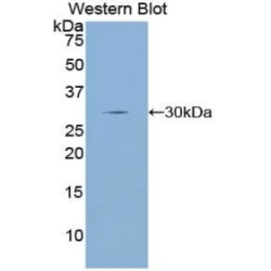 Dopamine Receptor D2 (DRD2) Antibody