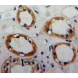 Enolase, Non Neuronal (NNE) Antibody